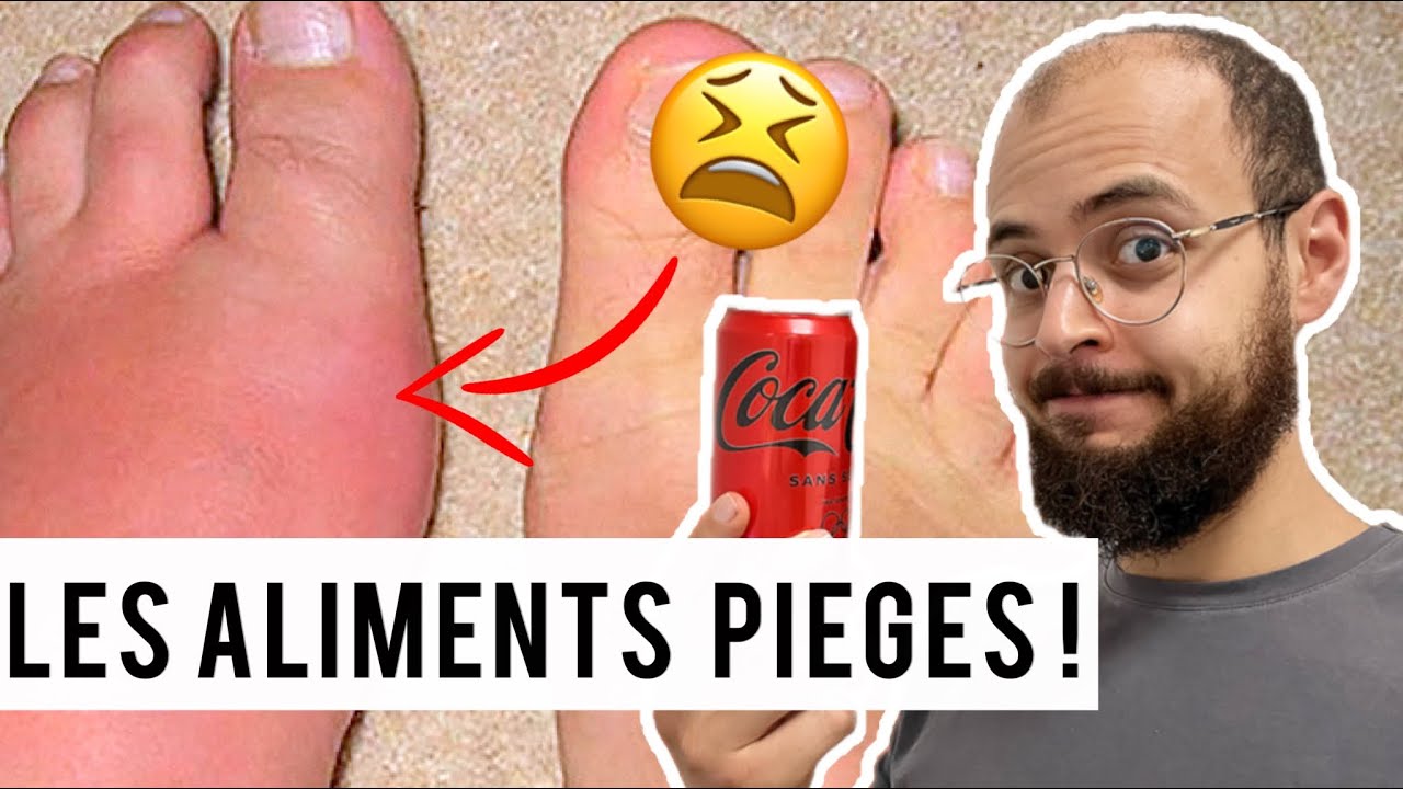 LA GOUTTE : LES ALIMENTS À ÉVITER !